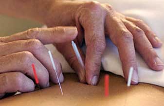 Iandra Acupuntura - Foto 1